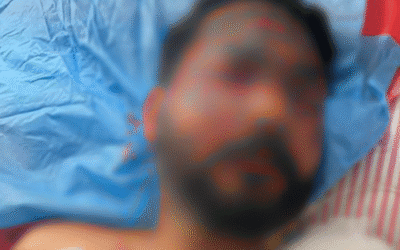 Punjab Police Break Silence: Constable Critically Injured in IED Blast at Amritsar SSOC Office