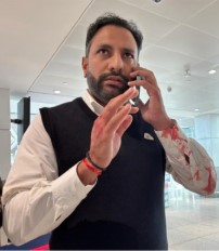 ਯਾਤਰੀ ਨਾਲ ਕੁੱਟਮਾਰ ਮਾਮਲੇ ਵਿਚ ਏਅਰ ਇੰਡੀਆ ਐਕਸਪ੍ਰੈੱਸ ਦਾ ਪਾਇਲਟ ਗ੍ਰਿਫਤਾਰ