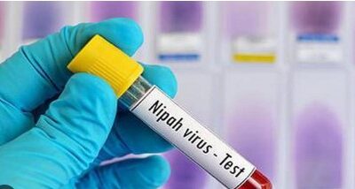 ਕੋਰੋਨਾ ਵਾਇਰਸ ਤੋਂ ਵੀ ਖਤਰਨਾਕ ਵਾਇਰਸ ਦੇ ਕਈ ਕੇਸ ਆਏ ਸਾਹਮਣੇ