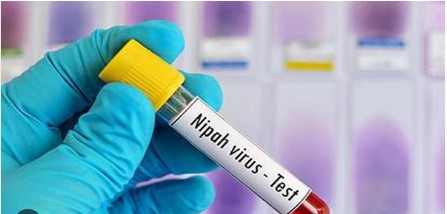 ਕੋਰੋਨਾ ਵਾਇਰਸ ਤੋਂ ਵੀ ਖਤਰਨਾਕ ਵਾਇਰਸ ਦੇ ਕਈ ਕੇਸ ਆਏ ਸਾਹਮਣੇ