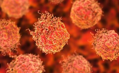 ਕੈਂਸਰ ਦੇ ਮਾਮਲਿਆਂ ਵਿਚ ਜੰਮੂ ਤੇ ਕਸ਼ਮੀਰ ਵਿਚ ਹੁੰਦਾ ਜਾ ਰਿਹੈ ਲਗਾਤਾਰ ਵਾਧਾ