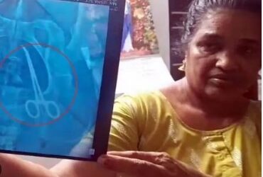 ਸਰਜਰੀ ਤੋਂ 5 ਸਾਲ ਬਾਅਦ ਔਰਤ ਦੇ ਪੇਟ `ਚੋਂ ਮਿਲਿਆ ਸਰਜੀਕਲ ਔਜ਼ਾਰ