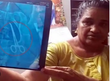 ਸਰਜਰੀ ਤੋਂ 5 ਸਾਲ ਬਾਅਦ ਔਰਤ ਦੇ ਪੇਟ `ਚੋਂ ਮਿਲਿਆ ਸਰਜੀਕਲ ਔਜ਼ਾਰ